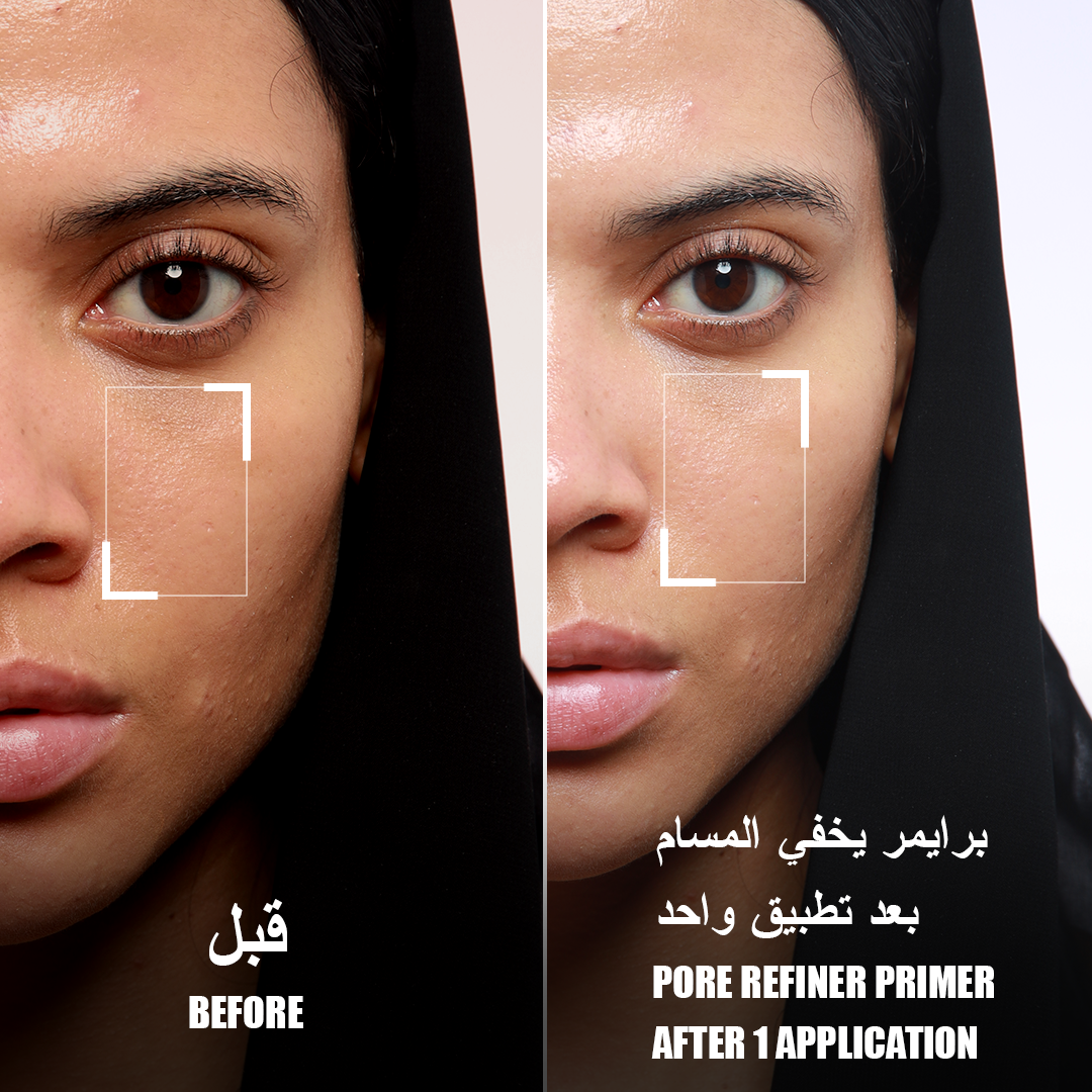 Layered Pore Refine